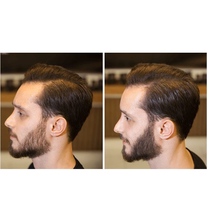 Fixbeard Açık Kahve