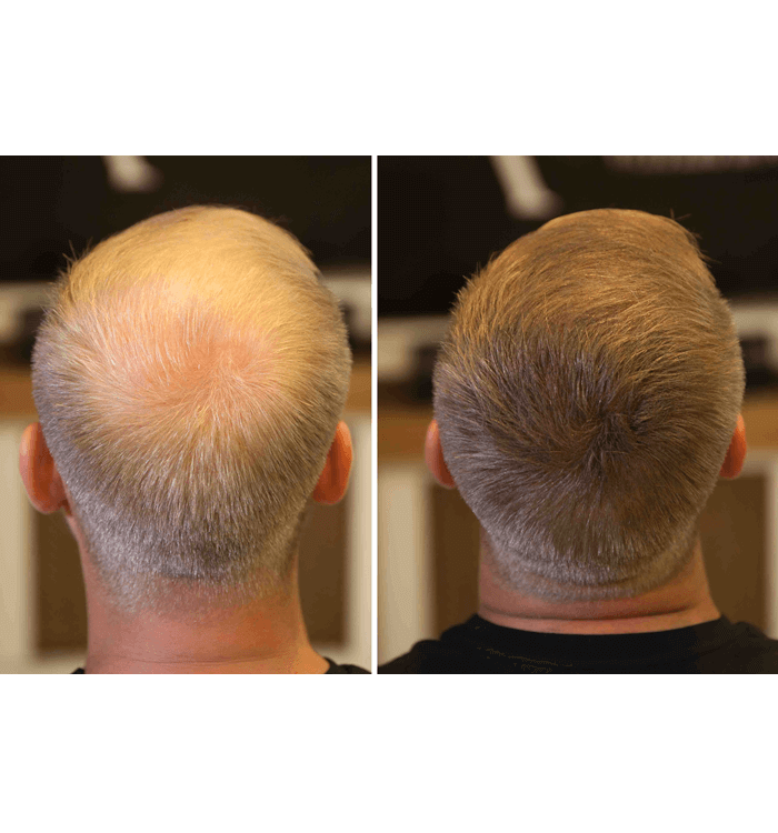 Fixplant 2 Şişe 56 Gram