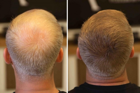 Saç Fiberleri ile Daha Kalın ve Gür Saçlara Sahip Olmak Mümkün!